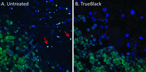Trueblack Immunofluorescence staining