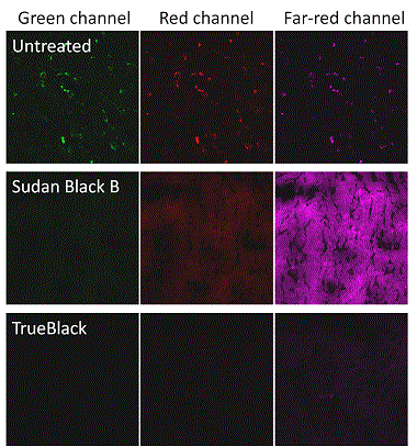 trueblack lipofuscin autofluorescence quencher vs Sudan B
